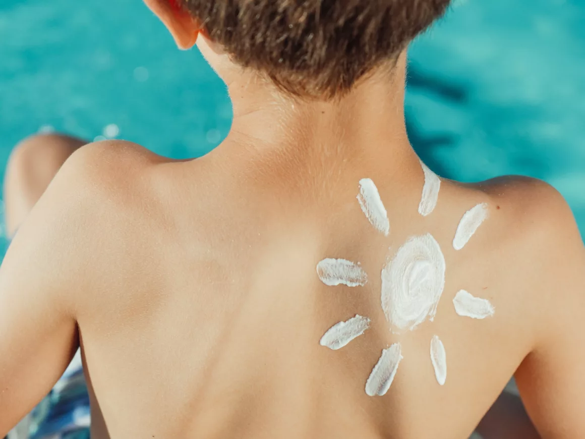 Sunscreen shape of sun on boys back