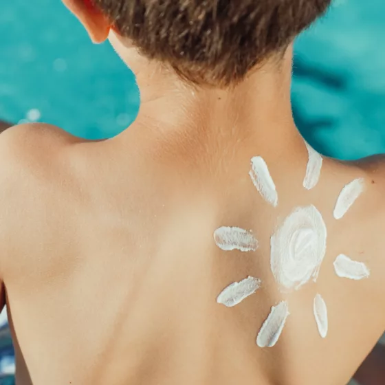 Sunscreen shape of sun on boys back